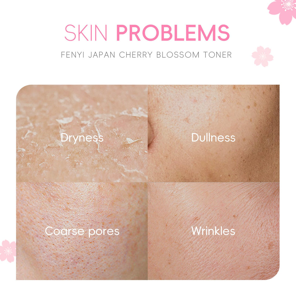 Fenyi Japanese Sakura Toner 100ml – Wet Compress Water