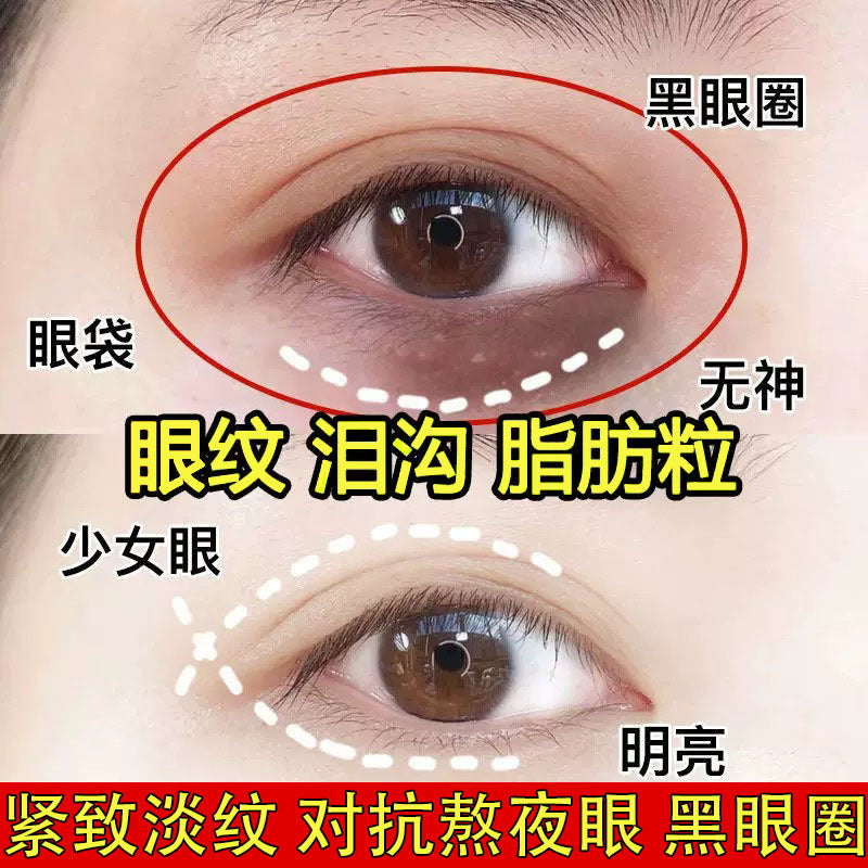 Anti-Wrinkle Eye Cream – Firming, Eye Bags & Dark Circles
