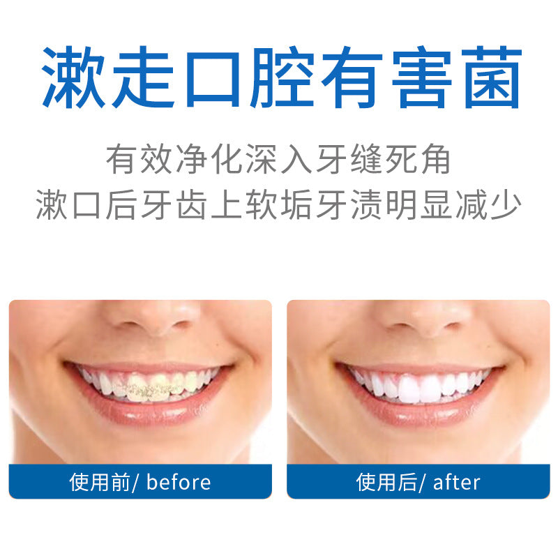 Bisutang Probiotic Anti-Odor Mouthwash