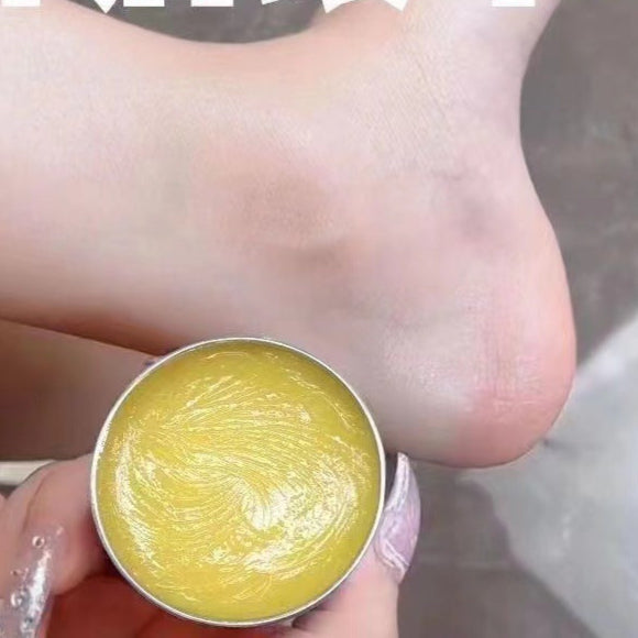 Four Seasons Cracked Heel Cream – Hand & Foot Repair Moisturizer